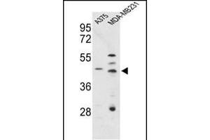 Western blot analysis of CTSD Antibody (C-term) (ABIN653399 and ABIN2842857) in , MDA-M cell line lysates (35 μg/lane). (Cathepsin D antibody  (C-Term))