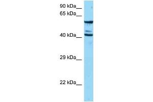 WB Suggested Anti-ESAM Antibody   Titration: 1. (ESAM antibody  (N-Term))