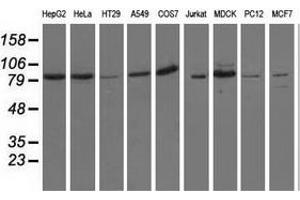 Western blot analysis of extracts (35 µg) from 9 different cell lines by using anti-OSBPL11 monoclonal antibody.