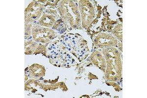 Immunohistochemistry of paraffin-embedded rat kidney using CDH6 antibody. (CDH6 antibody  (AA 1-250))