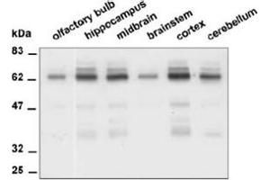 Western Blotting (WB) image for anti-Protein tyrosine Phosphatase, Receptor Type, R (PTPRR) antibody (ABIN1108794)