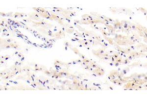 Detection of ITGb8 in Human Cardiac Muscle Tissue using Polyclonal Antibody to Integrin Beta 8 (ITGb8) (ITGB8 antibody  (AA 471-629))