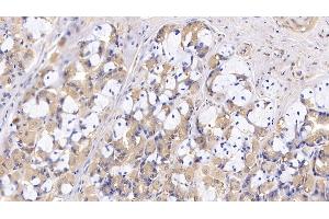 Immunohistochemistry (IHC) image for anti-Complement Component Receptor 1 (CD35) (CR1) (AA 1780-2039) antibody (ABIN7433177)
