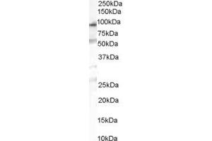 Western Blotting (WB) image for anti-Chitobiosyldiphosphodolichol beta-Mannosyltransferase (ALG1) (C-Term) antibody (ABIN2783688) (ALG1 antibody  (C-Term))