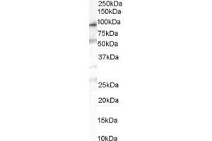 Western Blotting (WB) image for anti-Chitobiosyldiphosphodolichol beta-Mannosyltransferase (ALG1) (C-Term) antibody (ABIN2783688) (ALG1 antibody  (C-Term))
