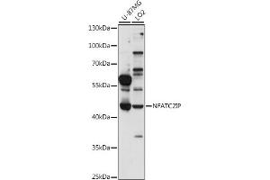 Western blot analysis of extracts of various cell lines, using NFIP antibody (ABIN7268978) at 1:1000 dilution. (NFATC2IP antibody  (AA 290-360))