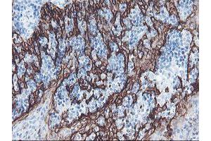 Image no. 1 for anti-Signal Recognition Particle Receptor, B Subunit (SRPRB) antibody (ABIN1501126) (SRPRB antibody)