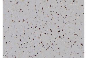 ABIN6276989 at 1/100 staining Human heart tissue by IHC-P. (Phospholipase C beta 1 antibody  (Internal Region))