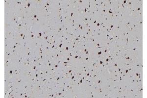 ABIN6276989 at 1/100 staining Human heart tissue by IHC-P.