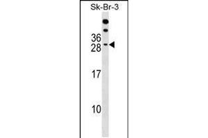 Western blot analysis in SK-BR-3 cell line lysates (35ug/lane). (RAP2B antibody  (AA 102-129))