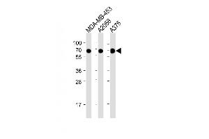 All lanes : Anti-CD63 Antibody (C-term) at 1:2000 dilution Lane 1: MDA-MB-453 whole cell lysate Lane 2:  whole cell lysate Lane 3:  whole cell lysate Lysates/proteins at 20 μg per lane.