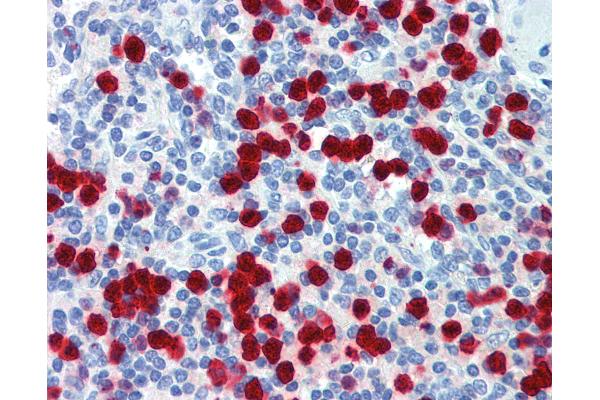 ZNF395 antibody  (C-Term)
