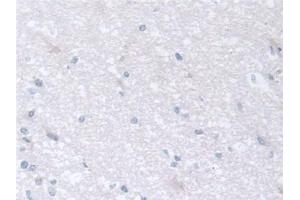 Detection of CCT2 in Human Cerebrum Tissue using Polyclonal Antibody to Chaperonin Containing TCP1, Subunit 2 (CCT2) (CCT2 antibody  (AA 1-488))