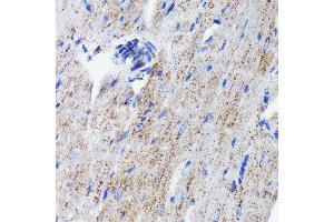 Immunohistochemistry of paraffin-embedded mouse heart using Cathepsin D antibody (ABIN7266149) at dilution of 1:100 (40x lens). (Cathepsin D antibody)