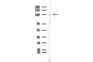 anti-Heat Shock 105kDa/110kDa Protein 1 (HSPH1) (C-Term) antibody