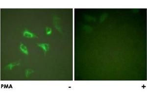 Immunofluorescence analysis of HeLa cells, treated with PMA (125 ng/mL, 30 mins), using YWHAZ polyclonal antibody . (14-3-3 zeta antibody)