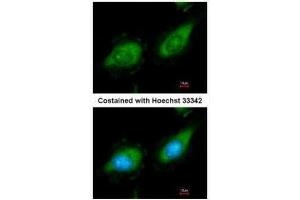 ICC/IF Image Immunofluorescence analysis of methanol-fixed HeLa, using MAP3K8, antibody at 1:200 dilution. (MAP3K8 antibody)
