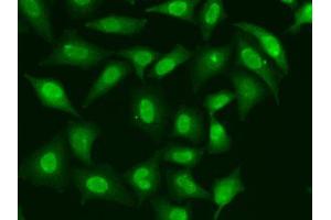 Immunofluorescence analysis of HeLa cells using TREX1 antibody. (TREX1 antibody  (AA 1-270))