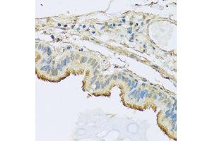 Immunohistochemistry of paraffin-embedded human trachea using NDUFB5 antibody at dilution of 1:100 (x40 lens).