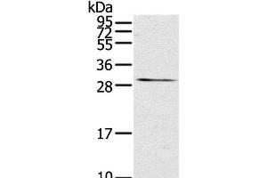 Western Blot analysis of Mouse kidney tissue using TNFSF15 Polyclonal Antibody at dilution of 1:600 (TNFSF15 antibody)