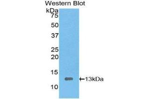 Western Blotting (WB) image for anti-High Mobility Group AT-Hook 1 (HMGA1) (AA 1-107) antibody (ABIN1078144) (HMGA1 antibody  (AA 1-107))