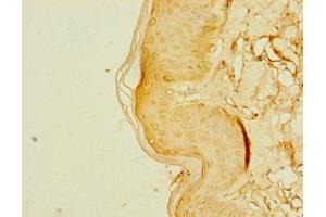 Immunohistochemistry of paraffin-embedded human skin tissue using ABIN7162558 at dilution of 1:100 (ZDHHC6 antibody  (AA 227-409))