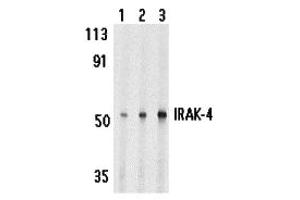 Western Blotting (WB) image for anti-Interleukin-1 Receptor-Associated Kinase 4 (IRAK4) (C-Term) antibody (ABIN1030445) (IRAK4 antibody  (C-Term))