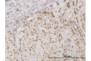 Image no. 1 for anti-Eukaryotic Translation Initiation Factor 2-alpha Kinase 2 (EIF2AK2) (AA 1-101) antibody (ABIN598901) (EIF2AK2 antibody  (AA 1-101))