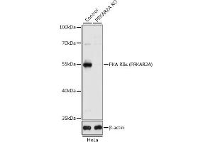 Western Blotting (WB) image for anti-Protein Kinase, CAMP-Dependent, Regulatory, Type II, alpha (PRKAR2A) (AA 1-404) antibody (ABIN1513416)