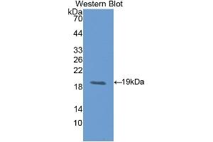 Detection of Recombinant LIFR, Rat using Polyclonal Antibody to Leukemia Inhibitory Factor Receptor (LIFR) (LIFR antibody  (AA 642-791))