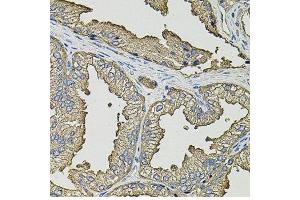 Immunohistochemistry of paraffin-embedded human prostate using SMN2 antibody. (SMN2 antibody  (AA 1-197))