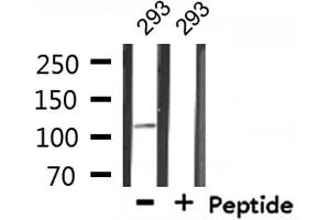 Western blot analysis of extracts from 293, using MED24 Antibody. (MED24 antibody  (C-Term))