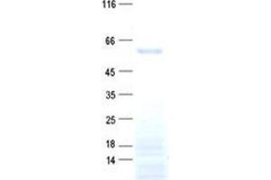 Validation with Western Blot (DMRTA1 Protein (His tag))