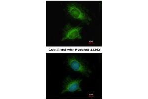 ICC/IF Image Immunofluorescence analysis of methanol-fixed HeLa, using PGM3, antibody at 1:200 dilution.