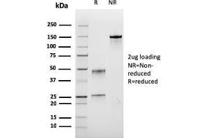 SDS-PAGE Analysis Puriifed BrdU Recombinant Mouse Monoclonal Antibody (rBRD. (Recombinant BrdU antibody)