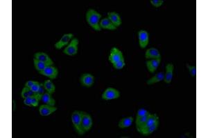 Immunofluorescence staining of HepG2 cells with ABIN7153343 at 1:266, counter-stained with DAPI. (GPR39 antibody  (AA 345-453))