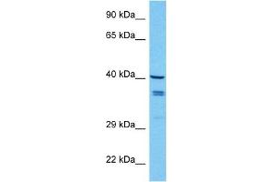 Host:  Mouse  Target Name:  WNT7B  Sample Tissue:  Mouse Spleen  Antibody Dilution:  1ug/ml (WNT7B antibody  (Middle Region))