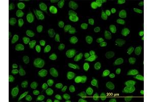 Immunofluorescence of monoclonal antibody to EMD on HeLa cell. (Emerin antibody  (AA 1-110))