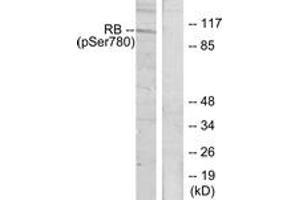 Western blot analysis of extracts from K562 cells treated with serum 10%, using Retinoblastoma (Phospho-Ser780) Antibody.