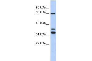 WB Suggested Anti-S100PBP Antibody Titration: 0. (S100PBP antibody  (Middle Region))