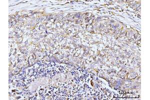 IHC analysis of GIT1 using anti-GIT1 antibody (ABIN7601683). (GIT1 antibody  (AA 415-736))