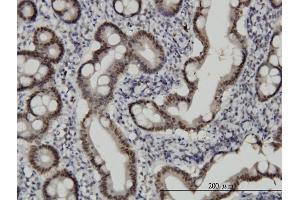 Immunoperoxidase of monoclonal antibody to CHFR on formalin-fixed paraffin-embedded human small Intestine. (CHFR antibody  (AA 1-652))