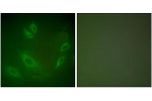 Immunofluorescence analysis of HeLa cells, using HSP105 Antibody.