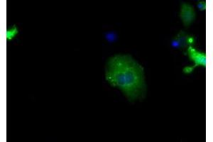 Image no. 2 for anti-Sorting Nexin 9 (SNX9) antibody (ABIN1501047) (SNX9 antibody)