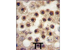 Formalin-fixed and paraffin-embedded human testis tissue reacted with YBX2 polyclonal antibody  , which was peroxidase-conjugated to the secondary antibody, followed by DAB staining. (YBX2 antibody  (C-Term))