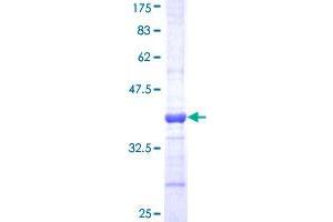 Image no. 1 for Superoxide Dismutase 3, Extracellular (SOD3) (AA 26-125) protein (GST tag) (ABIN1320950) (SOD3 Protein (AA 26-125) (GST tag))