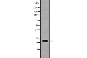 Western blot analysis SFT2D3 using HT-29 whole cell lysates (SFT2D3 antibody  (N-Term))