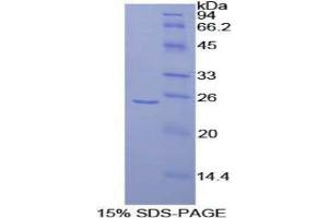 SDS-PAGE (SDS) image for Fibroblast Growth Factor Receptor Substrate 2 (FRS2) (AA 268-453) protein (His tag) (ABIN2124829)