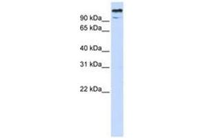 Image no. 1 for anti-Zinc Finger and BTB Domain-Containing Protein 10 (ZBTB10) (AA 36-85) antibody (ABIN6740518) (ZBTB10 antibody  (AA 36-85))