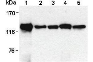 Western Blotting (WB) image for anti-Signal-Induced Proliferation-Associated 1 (SIPA1) antibody (ABIN1449259) (SIPA1 antibody)